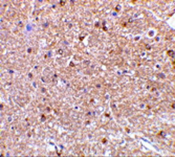 RTN4 Antibody