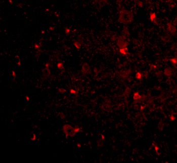 RTN4 Antibody