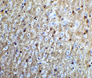 RTN4 Antibody