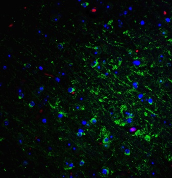 NogoA Antibody
