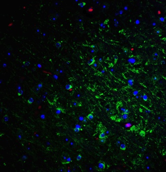 RTN4 Antibody