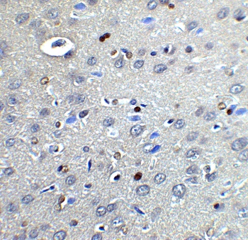 NOX2 Antibody