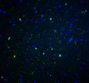 NOX2 Antibody