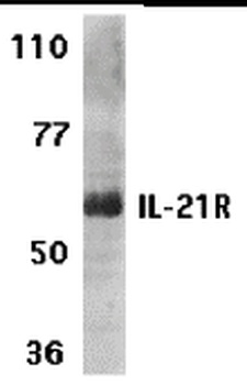 IL-21 Receptor Antibody