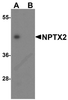 NPTX2 Antibody