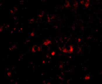 NPTX2 Antibody