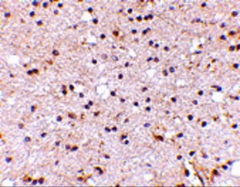 NPTX2 Antibody