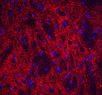 NPTX2 Antibody