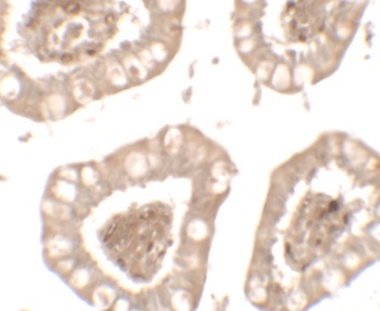 IL1RL2 Antibody