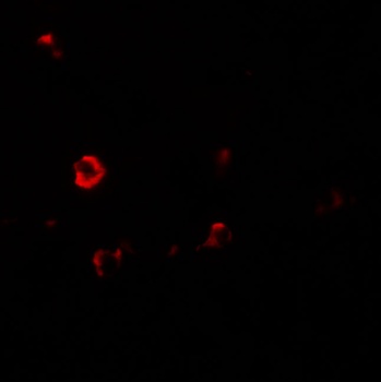 IL-1RL2 Antibody