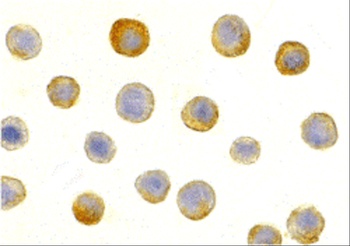 IL-1RAcP Antibody