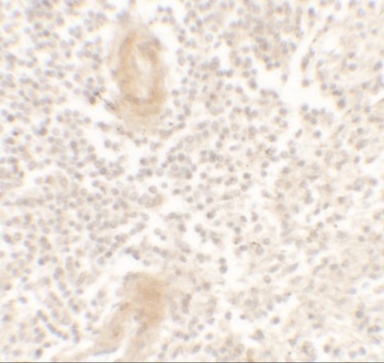 IL-1F10 Antibody