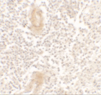 IL1F10 Antibody