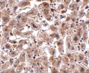 OCLN Antibody