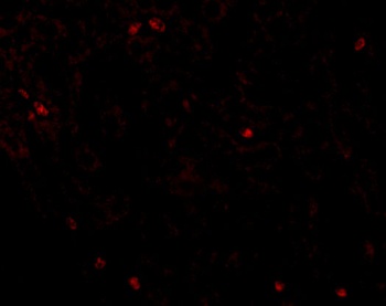 OCLN Antibody