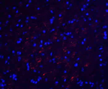 OCLN Antibody