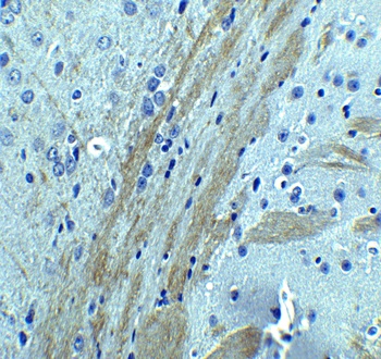 OCLN Antibody