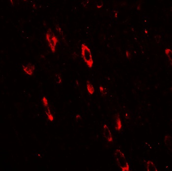 OLIG2 Antibody