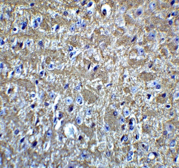 OLIG2 Antibody