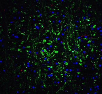 OLIG2 Antibody