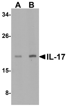 IL17A Antibody