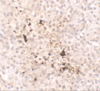 IL15 Antibody