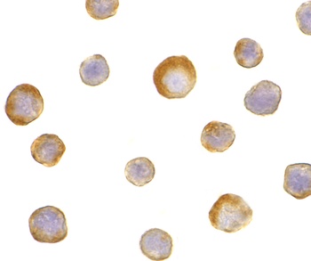 IKBKG Antibody