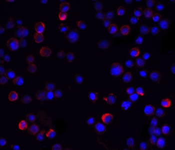 IKBKG Antibody