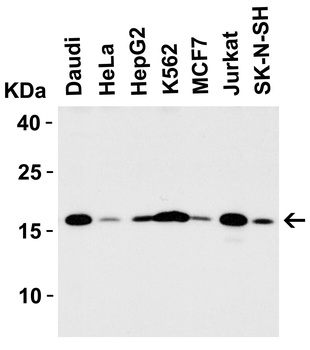 STMN1 Antibody