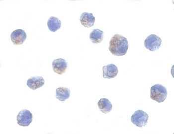 CHUK Antibody