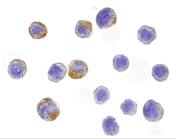 CHUK Antibody