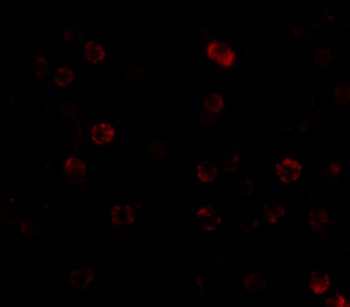 CHUK Antibody
