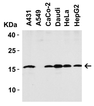 STMN1 Antibody