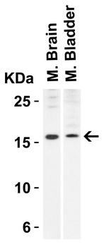 STMN1 Antibody