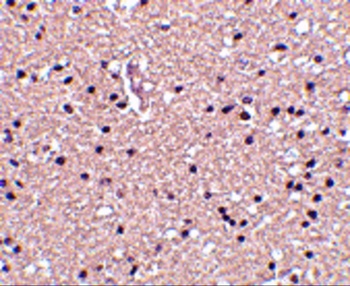 STMN1 Antibody