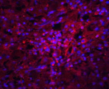ORAI1 Antibody