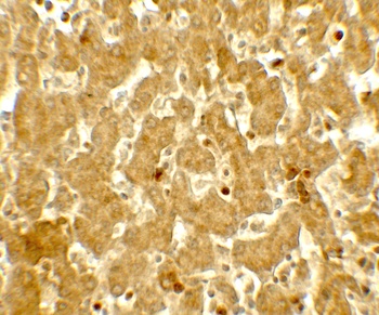 IFIT3 Antibody