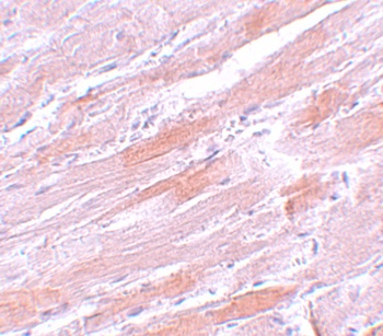 IDH2 Antibody