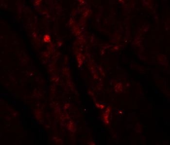 IDH2 Antibody