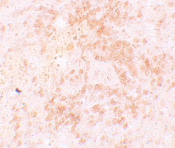 HVCN1 Antibody