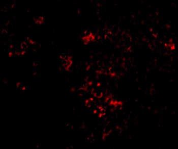 PAK2 Antibody