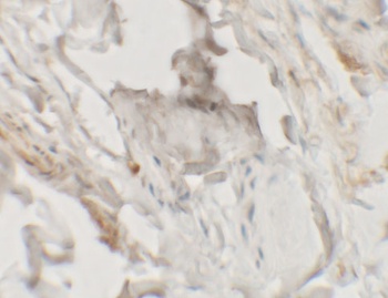 HHATL Antibody