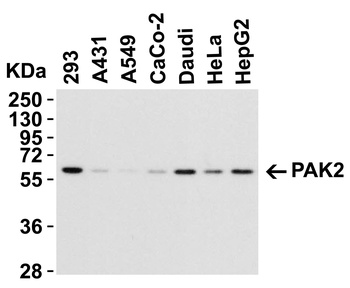 PAK2 Antibody