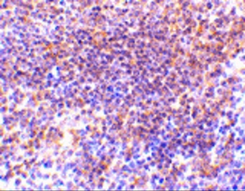 PAK2 Antibody