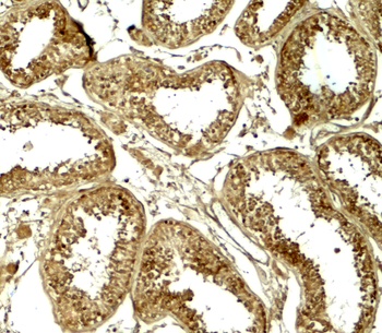 HDAC6 Antibody