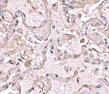 GSTP1 Antibody