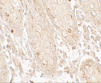 GRK6 Antibody