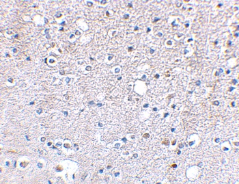 GRIK5 Antibody