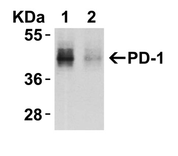 PD-1 Antibody