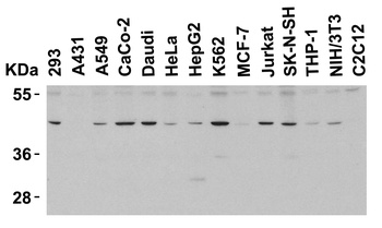 PD-1 Antibody